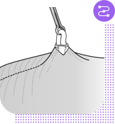 No-scalpel vasectomy procedure, step 7